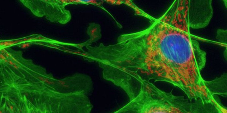 PCR熒光濾光片成像圖 PCR熒光濾光片成像圖